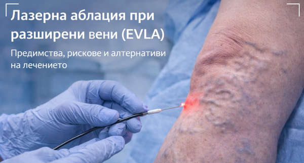 лазерна аблация на пациент с разширени вени